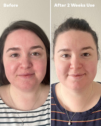 The Original MakeUp Eraser - Silver Infused Mini PRO MakeUp Eraser | Acne Prone Skin